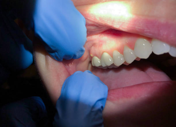 Best Cracked Tooth Emergency Dentist  in Mountain View Ranches, AZ
